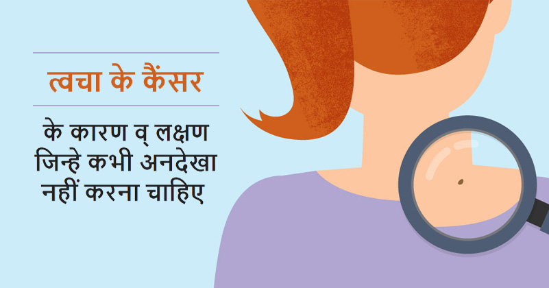 causes-and-symptoms-of-skin-cancer-in-hindi